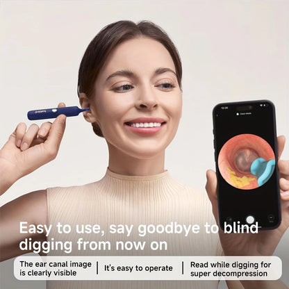 Smart Ear Cleaning Device – Safe & High-Tech Ear Care